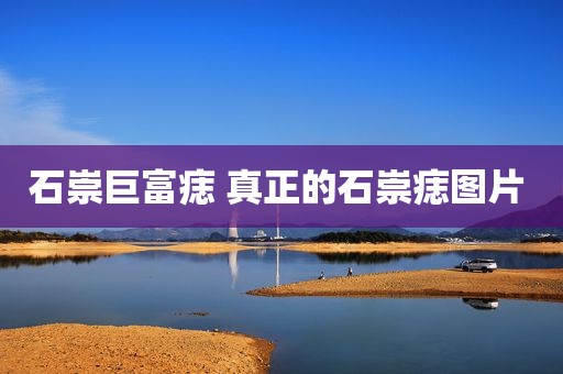 石崇巨富痣 真正的石崇痣图片 