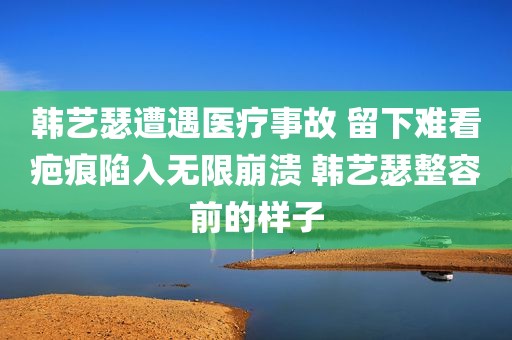 韩艺瑟遭遇医疗事故 留下难看疤痕陷入无限崩溃 韩艺瑟整容前的样子