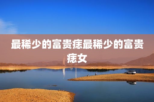 最稀少的富贵痣最稀少的富贵痣女