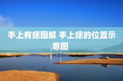 手上有痣图解 手上痣的位置示意图 