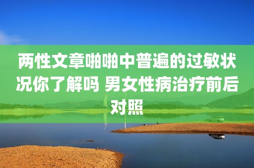 两性文章啪啪中普遍的过敏状况你了解吗 男女性病治疗前后对照