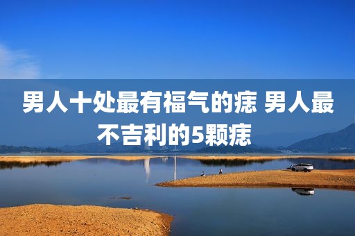 男人十处最有福气的痣 男人最不吉利的5颗痣 