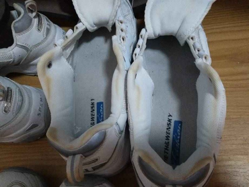 你的小白鞋为啥总悄悄变黄 这些坑千万别再踩了