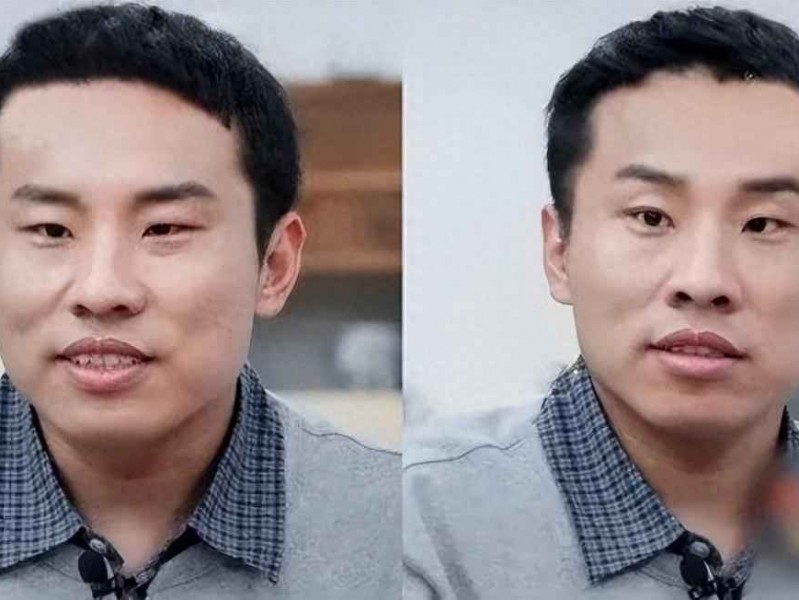 小脸男生形象提升秘籍：中医美容让脸自然变小，医生亲授不用开刀的秘诀